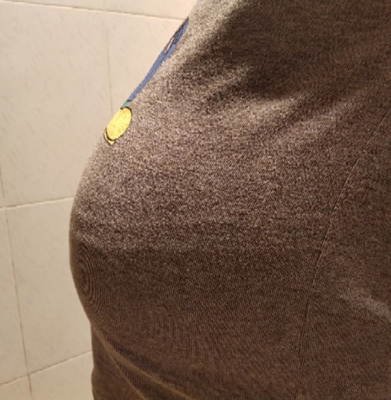 给大家报喜来啦，2019年12.16金贝生殖中心剖腹一个男宝宝，出生6斤5两！